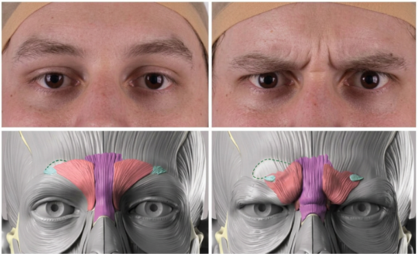 Forehead Lift Effects: How Your Facial Impression Can Change 사진 10