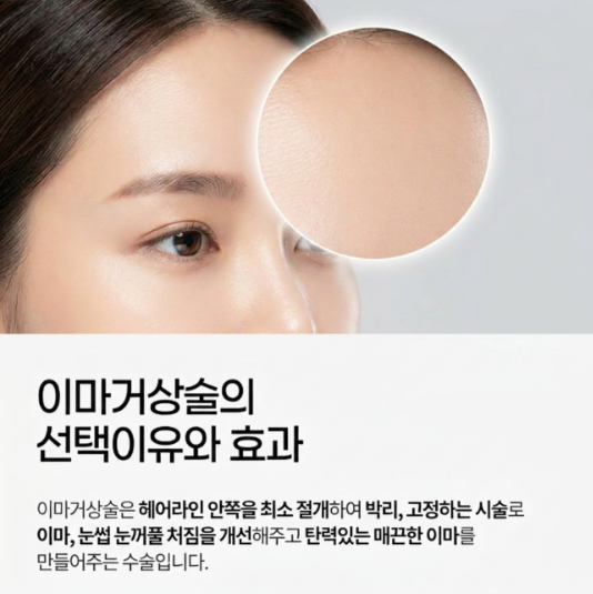 Forehead Lift Effects: How Your Facial Impression Can Change 사진 4