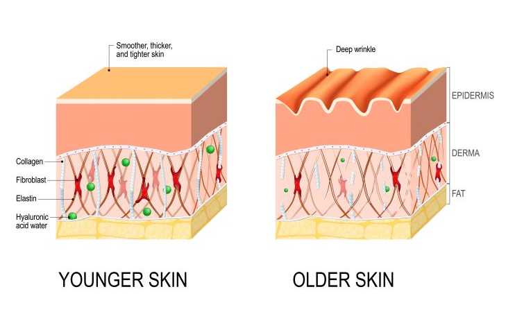 Durasi Mini Facelift, Perbedaan Antara Orang yang Bertahan Lama dan yang Singkat 사진 5