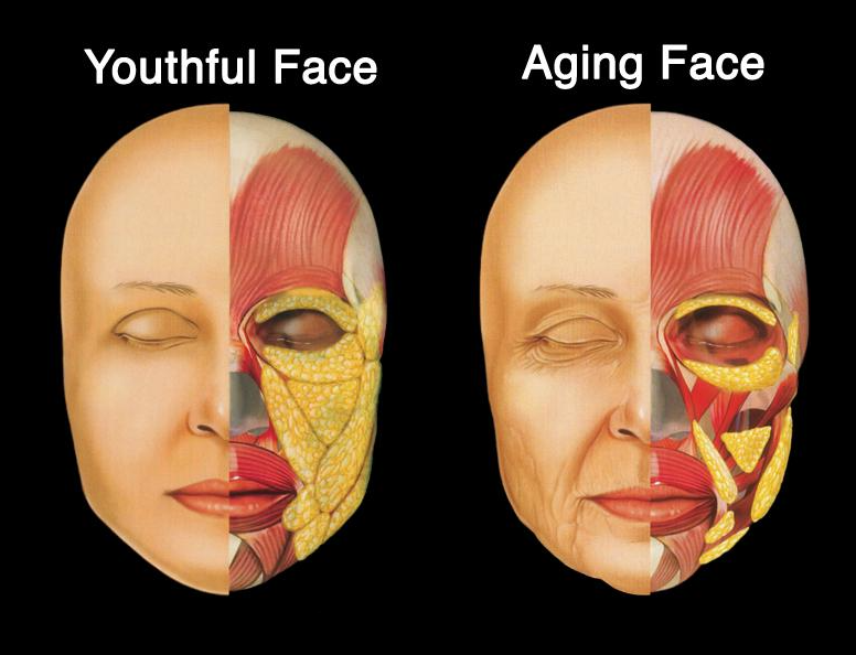 Midface Reduction Procedures: Why Your Face Looks Different Even If Its Length Remains the Same 사진 8