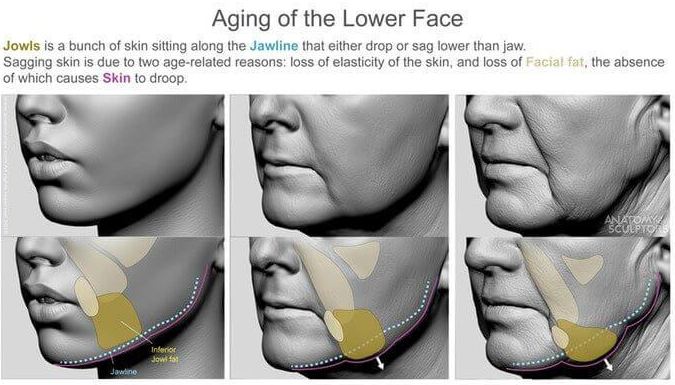 Marionette Line Treatment: Why Filling Wrinkles Alone Isn't Enough