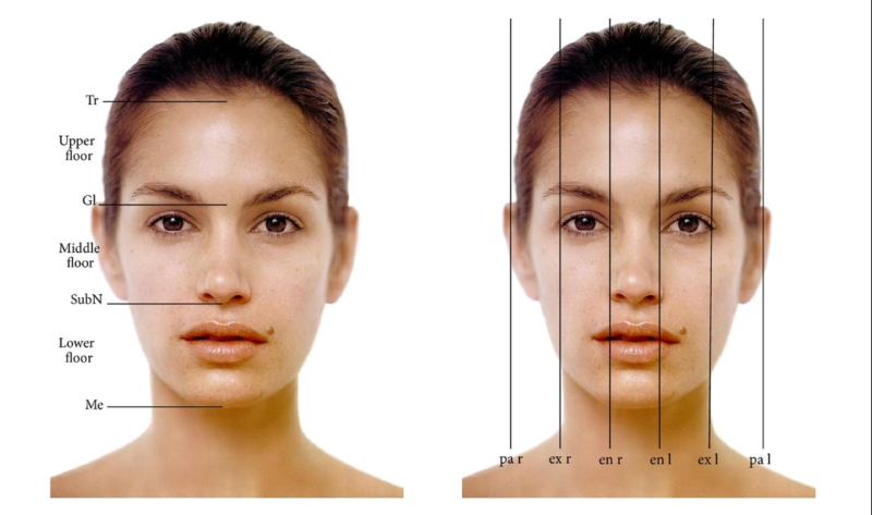 Marionette Line Treatment: Why Filling Wrinkles Alone Isn't Enough 사진 9