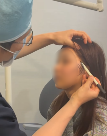 Gangnam Facelift: Why Does the Face Look Unnatural? 사진 8