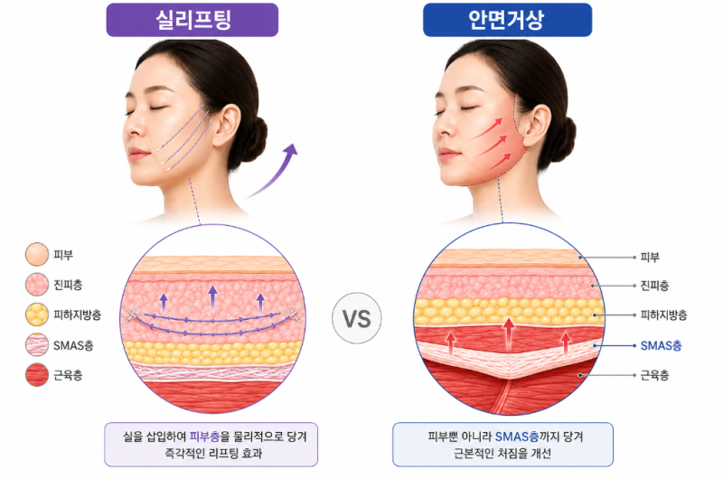 Nonhyeon Station Plastic Surgery: A Comprehensive Guide to Facelifts vs. Thread Lifts 사진 5