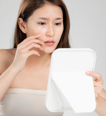 Facelift for Twenties: What to Check Before Age 사진 9