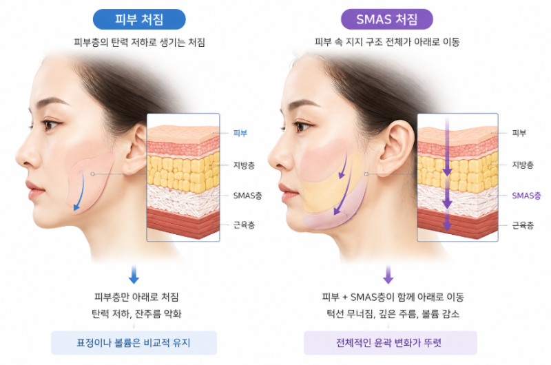 Facelift for Twenties: What to Check Before Age 사진 6