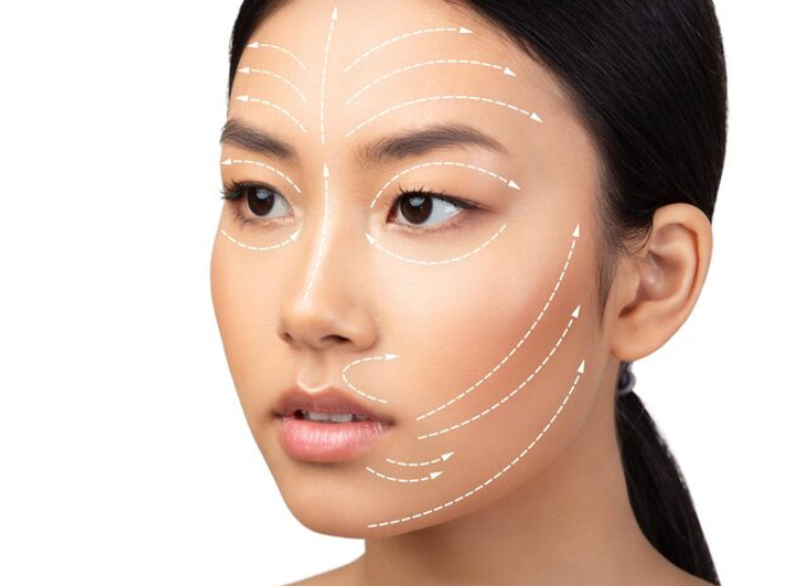 Gangnam Thread Lift Reviews: What Changes Can Be Seen in Before & After Photos? 사진 4