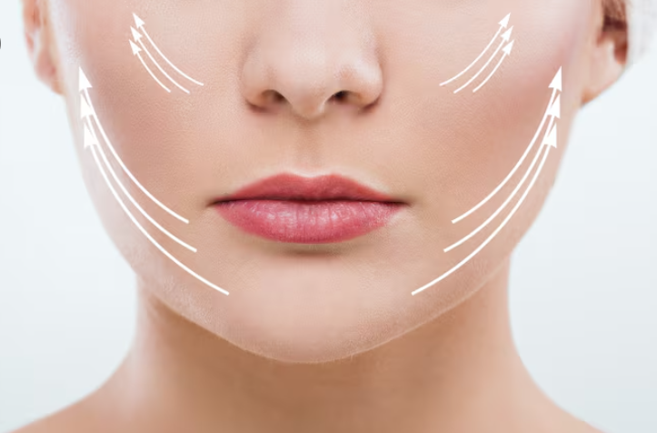 Gangnam Station Thread Lift Price: Why Do Clinics Differ? 사진 9