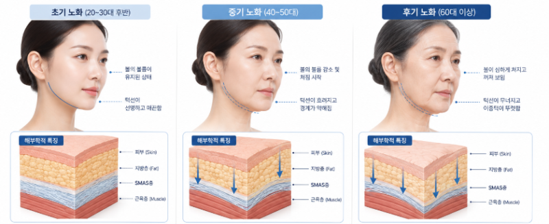 Efek Mini Facelift, Kapan Tingkat Kepuasannya Lebih Tinggi dari Lifting? 사진 7