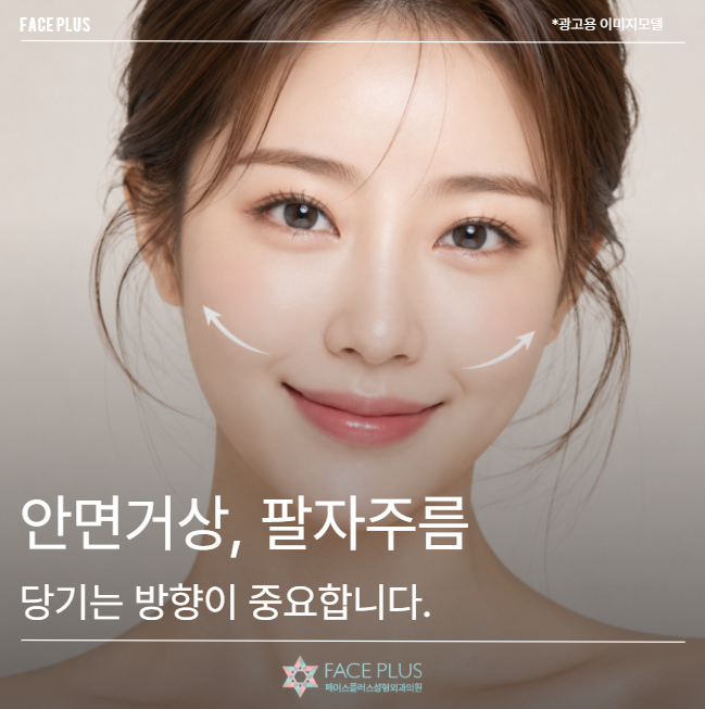 Facelift: The ‘Direction of Pull’ is Crucial for Improving Nasolabial Folds