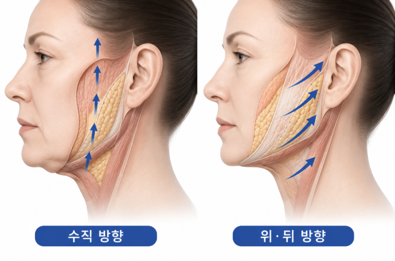 Gangnam Facelift Clinic: The Difference in Lifting for a Defined Jawline 사진 5