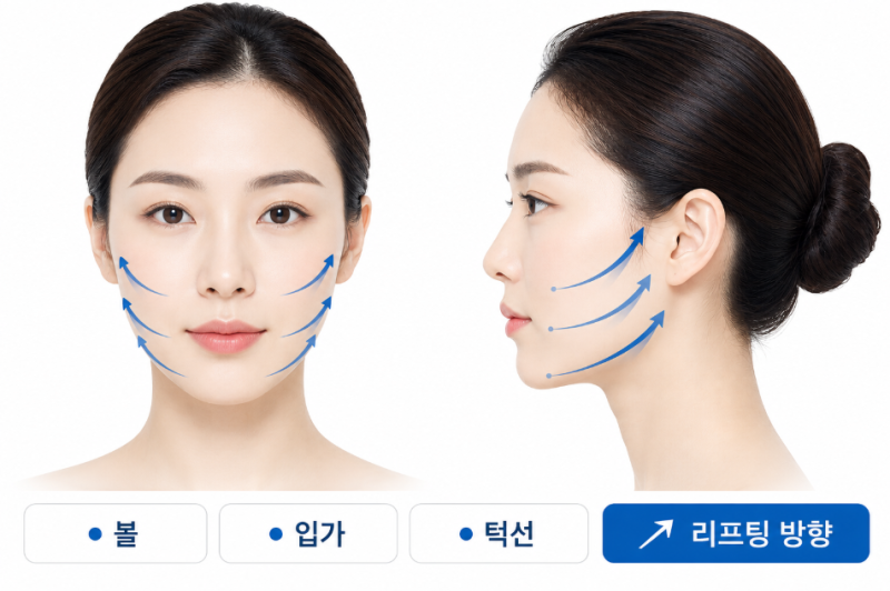 Gangnam Facelift Clinic: The Difference in Lifting for a Defined Jawline 사진 6