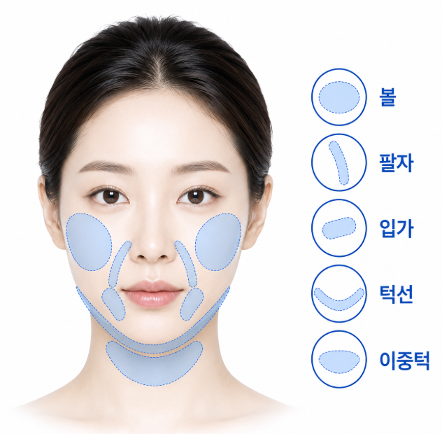 Seoul Jamber Thread Lift: Why the Same Thread Yields Different Results 사진 4