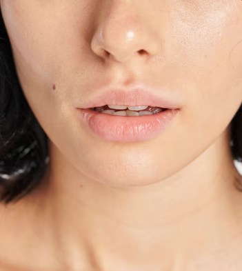 Seoul Plastic Surgery: The Reason Your Vibe Changes with Just Lip Fillers 사진 10