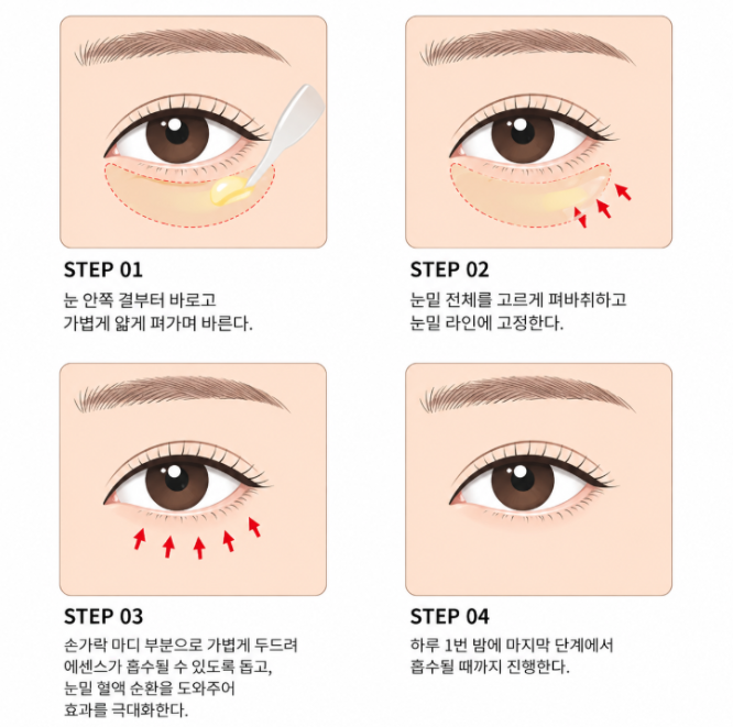 Nonhyeon Plastic Surgery: When Should You Consider Under-Eye Fat Repositioning? 사진 8