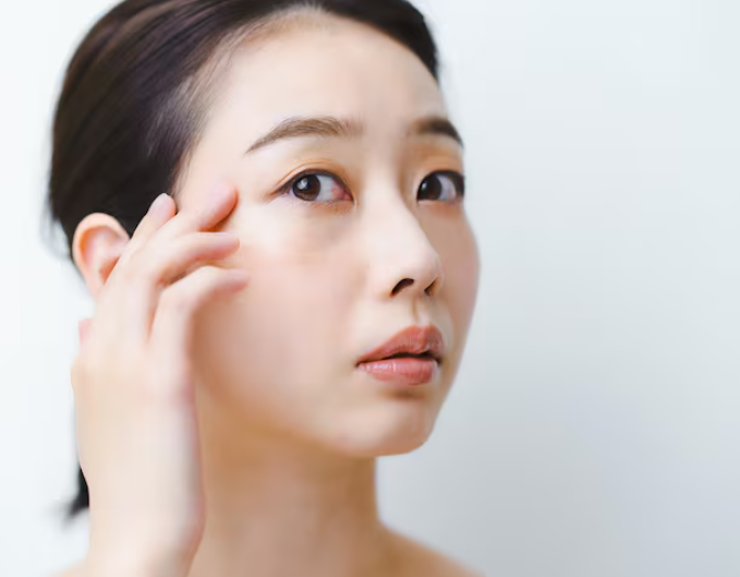 Nonhyeon Plastic Surgery: When Should You Consider Under-Eye Fat Repositioning? 사진 9