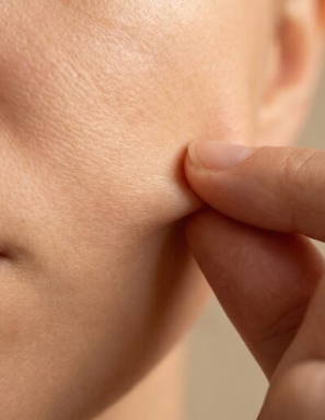 Sinsa Station Plastic Surgery: How to Maintain Ultherapy Prime Effects for Longer? 사진 5