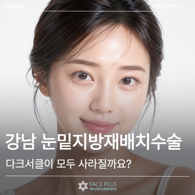 Gangnam Under-Eye Fat Repositioning Surgery: Will All Dark Circles Disappear?