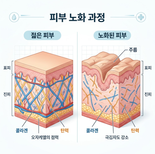 서울 얼굴주름리프팅, 나이보다 어려 보이는 비결은 무엇일까요? 사진 3