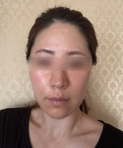 서울 얼굴주름리프팅, 나이보다 어려 보이는 비결은 무엇일까요? 사진 5