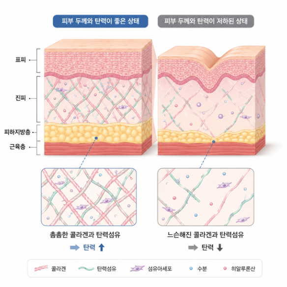Nasolabial Fold Filler: 3 Essential Checks Before Getting It 사진 7
