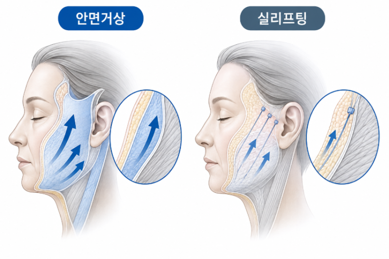 Considering Middle-Aged Eye Surgery? The Difference Between Upper Blepharoplasty, Lower Blepharoplasty, and Facelift 사진