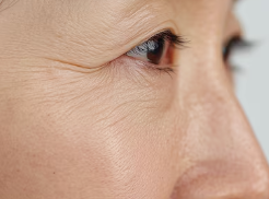 Considering Middle-Aged Eye Surgery? The Difference Between Upper Blepharoplasty, Lower Blepharoplasty, and Facelift 사진