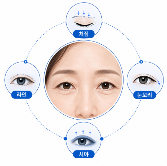 What's the Difference Between Upper Blepharoplasty and Double Eyelid Surgery for People in Their 50s? 사진 7