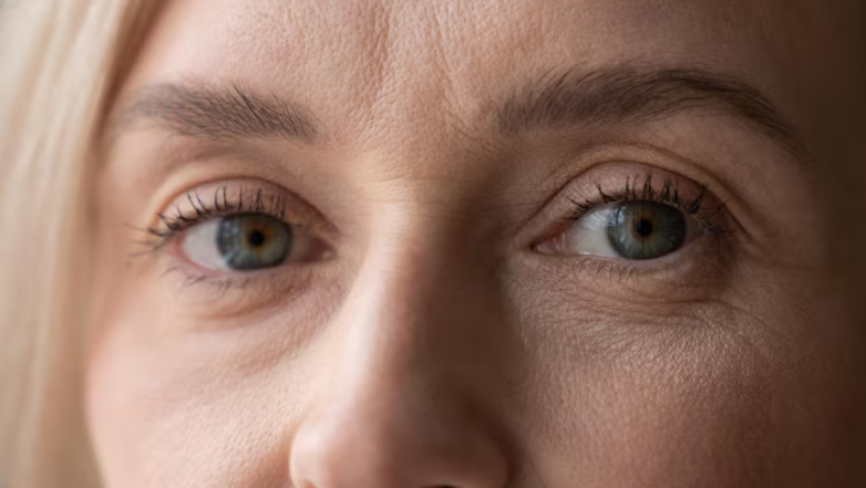 Lower Blepharoplasty for Those in Their 50s: Is Removing Only Under-Eye Fat Enough?