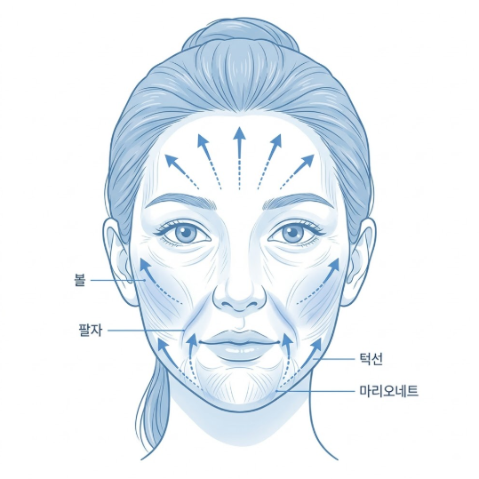 Gangnam Thread Lift Guide: Making an Unregrettable Choice for a Thread Lift 사진 4