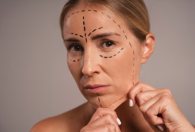 Gangnam Facelift Experts: What You Can't Learn from Online Searches Alone 사진 2