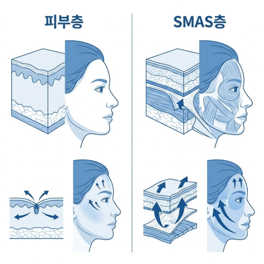 Gangnam Facelift Experts: What You Can't Learn from Online Searches Alone 사진 5
