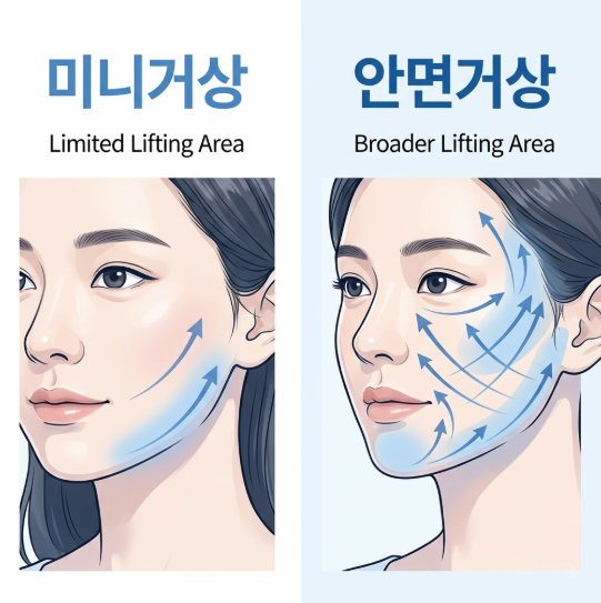Gangnam Mini Facelift Clinic: How Does a Mini Facelift Differ from a Full Facelift? 사진 5