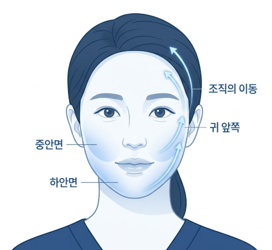 Gangnam Mini Facelift Clinic: How Does a Mini Facelift Differ from a Full Facelift? 사진 4