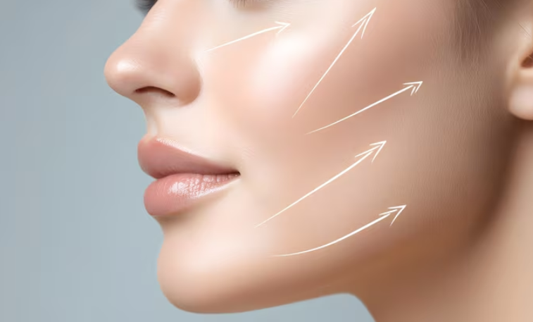 Looking for a good thread lift clinic in Seoul? A comprehensive guide to thread lift types and features