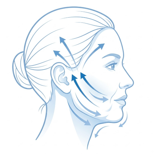 Looking for a good thread lift clinic in Seoul? A comprehensive guide to thread lift types and features 사진 4