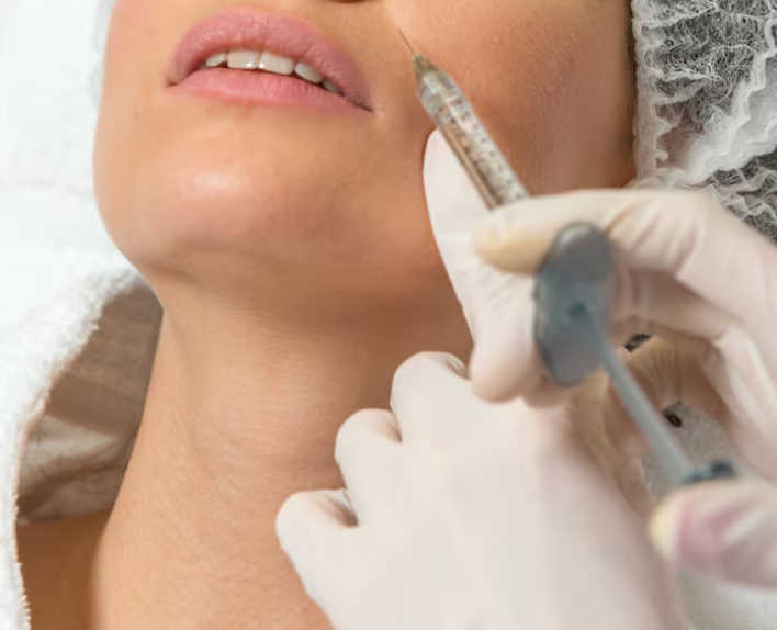 Facelift: Will I regret getting it too early? 사진 6