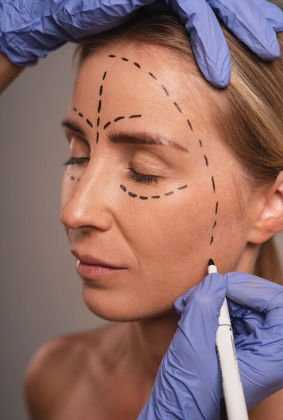 Facelift: Will I regret getting it too early? 사진 2