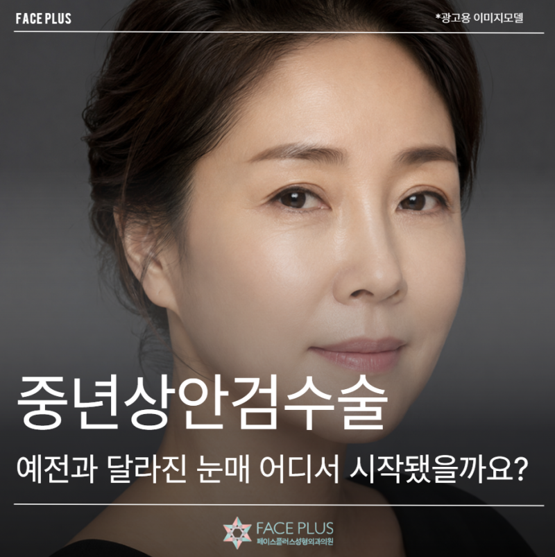 Middle-Aged Upper Blepharoplasty: Where Did the Change in Eyelid Shape Begin?