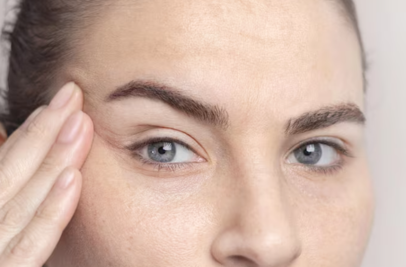 Why 60s Lower Blepharoplasty May Differ from 50s Surgery 사진 9