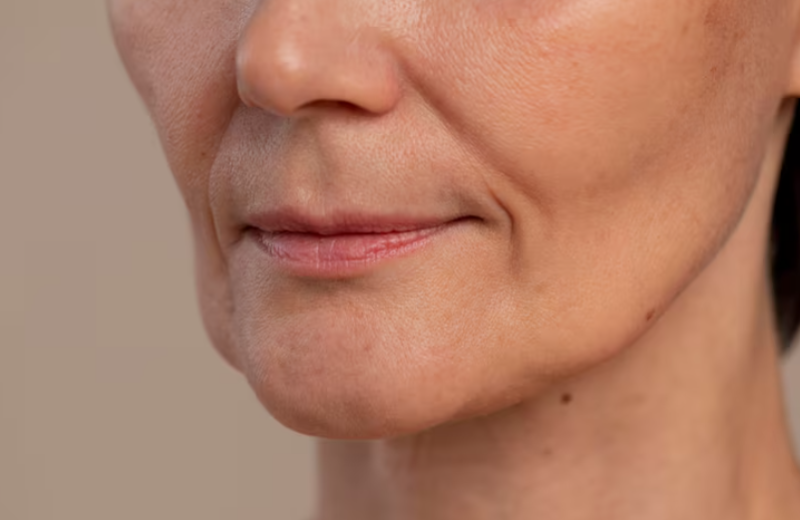 Gangnam Plastic Surgery: How Long Do Facelift Effects Last? 사진 5