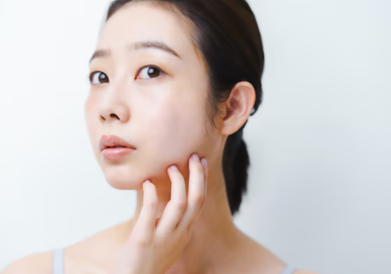 Facial Thread Lift Cost: Does More Threads Always Mean Better Results? 사진 9