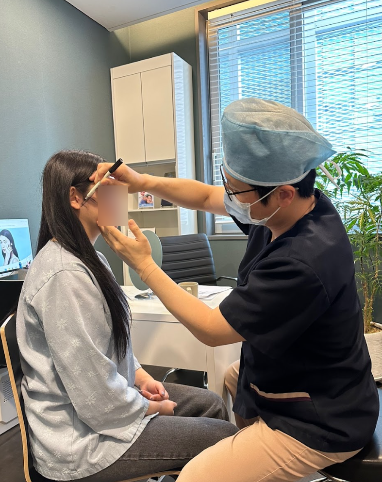 Facial Thread Lift Cost: Does More Threads Always Mean Better Results? 사진 6