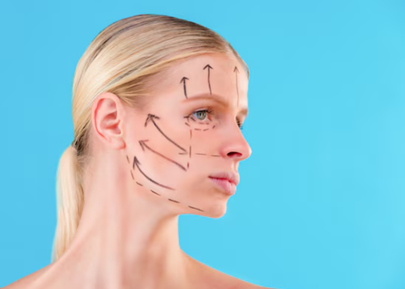 Facelift Surgery: At What Age Should You Consider It? Why Even Those in Their 20s and 30s Might Need It 사진 6