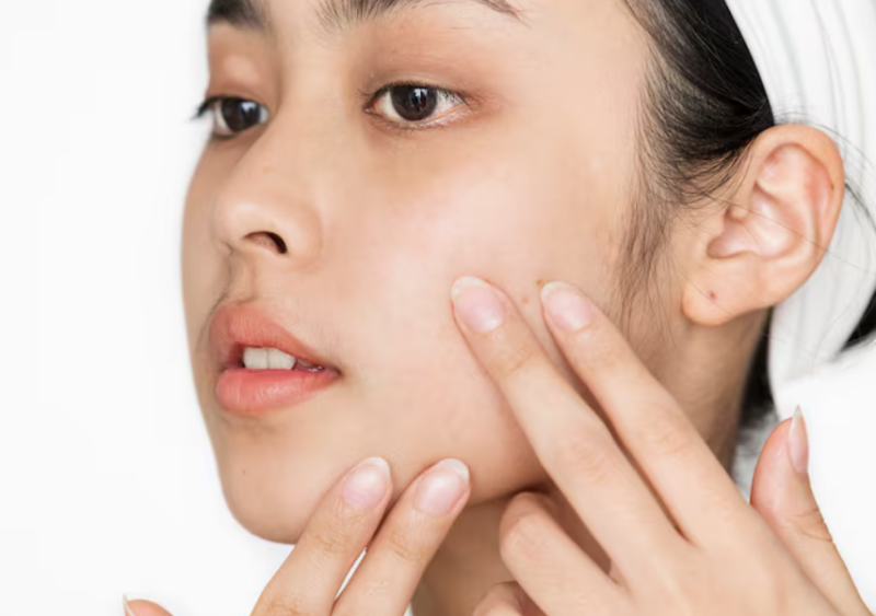 Thread Lift Pain: Is It Bearable? What to Know Before the Procedure 사진 5