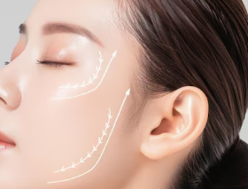 강남 실리프팅잘하는곳, 얼굴이 처져 보인다면 실 개수보다 중요한 것은? 사진 5