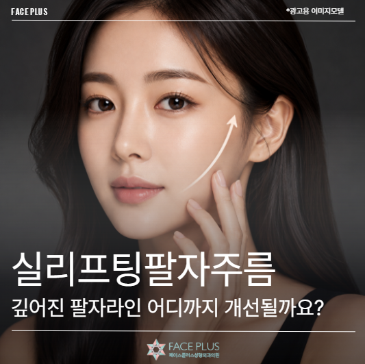 Thread Lift for Nasolabial Folds: How Much Improvement Can Be Expected for Deepened Lines?