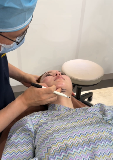 Thread Lift for Nasolabial Folds: How Much Improvement Can Be Expected for Deepened Lines? 사진 6