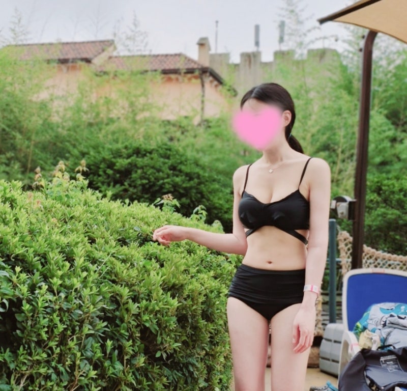 Ulasan Motiva 1 Tahun 4 Bulan_Next Plastic Surgery Clinic