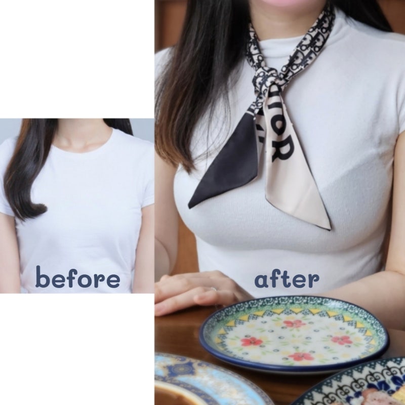 Ulasan Motiva 1 Tahun 4 Bulan_Next Plastic Surgery Clinic